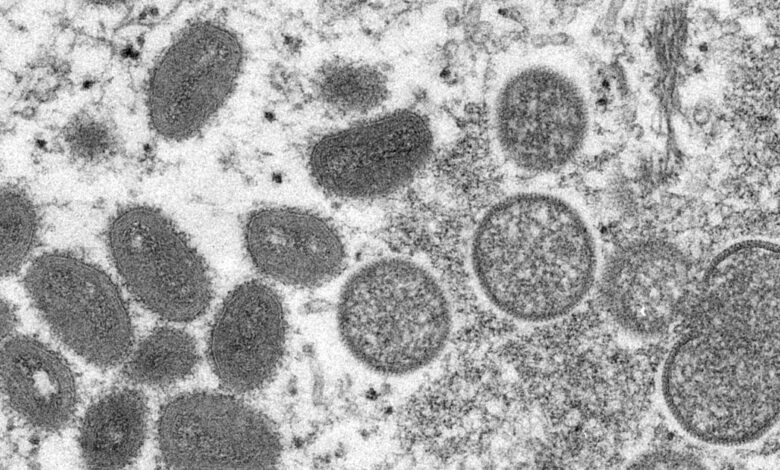 France, Germany, Belgium report first monkeypox virus cases
