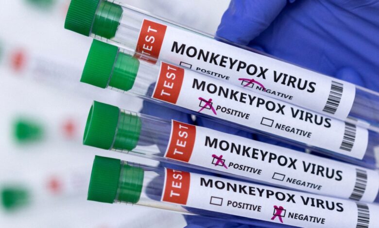 Monkeypox has likely spread undetected ‘for some time’: WHO