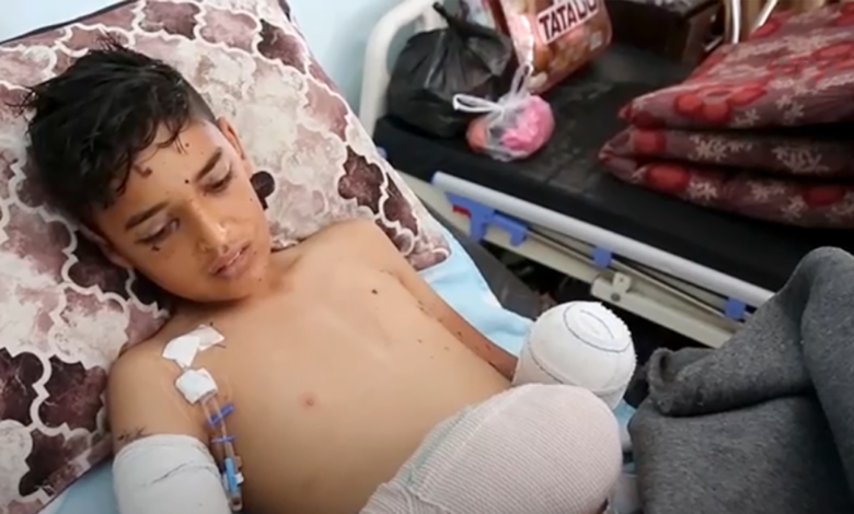 Gaza teenager loses fingers due to explosives hidden in bottle